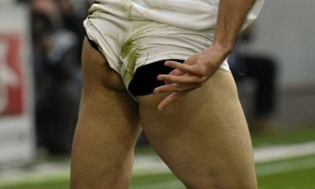 Ποιος ποδοσφαιριστής είχε αυτό το… ατύχημα;