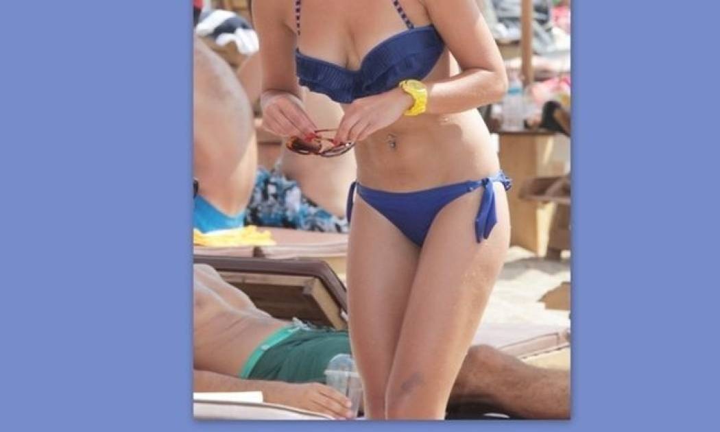 Ουπς! Ποιος σε μελάνιασε; (φωτό)