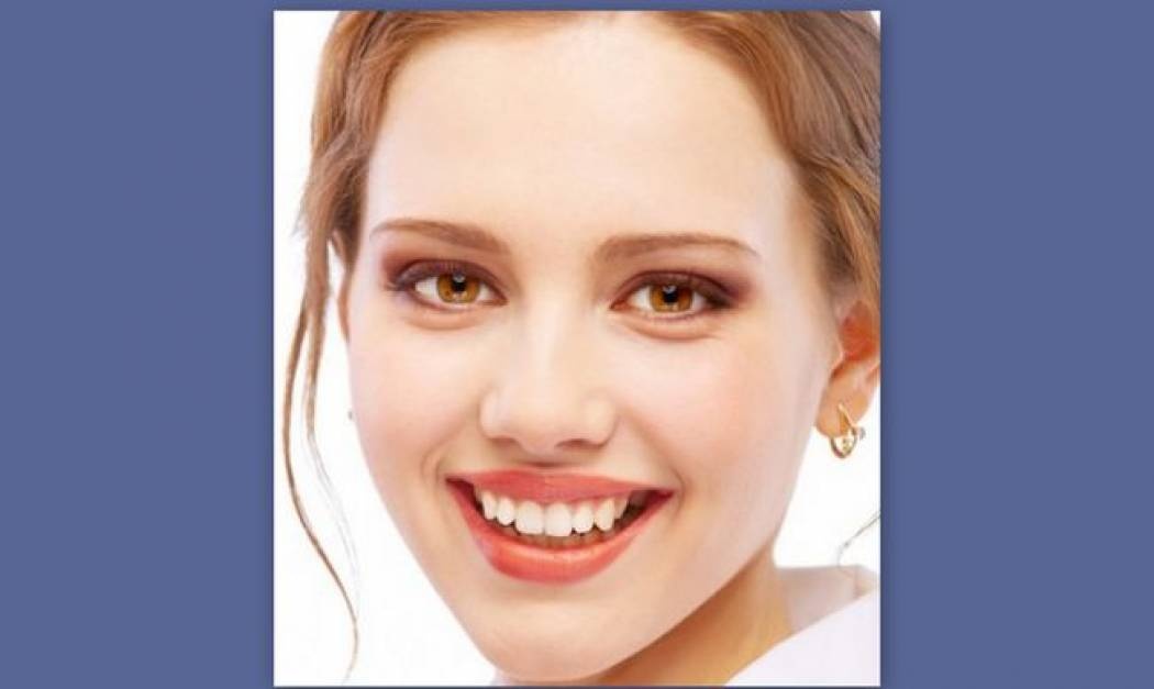 Τι κάνουμε όταν μετά το τέλος της ορθοδοντικής θεραπείας τα δόντια μας δεν είναι λεία