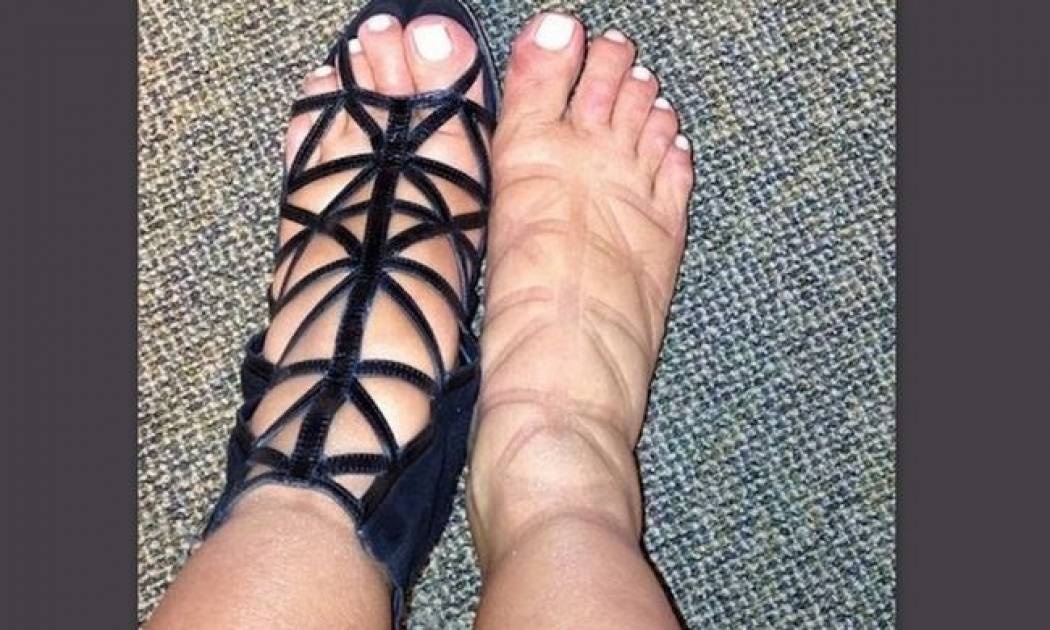 Το… δράμα διάσημης με τα ψηλοτάκουνα πέδιλα!