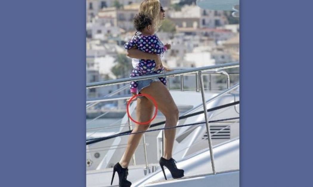 H Beyonce, το καυτό σορτς και η… κυτταρίτιδα!