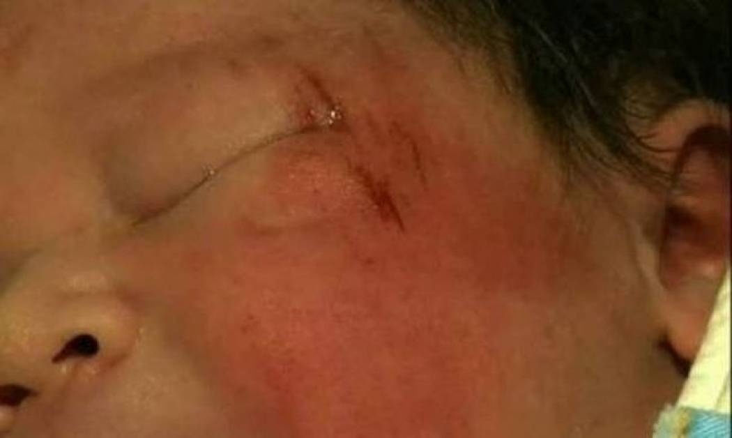 Γεννήθηκε στην άσφαλτο λίγο πριν ξεψυχήσει η μητέρα του (pic&vid)