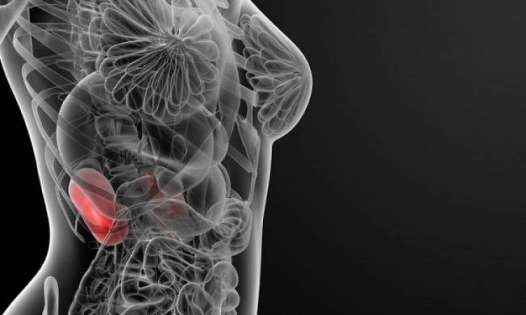 Πέτρες στα νεφρά: Οι 2 θανάσιμοι κίνδυνοι που κρύβουν