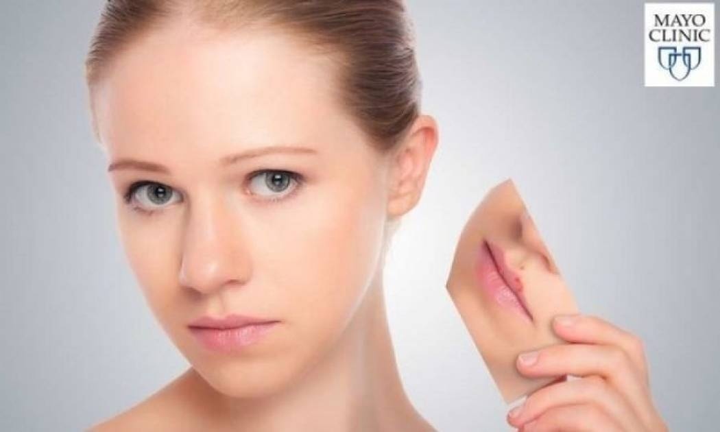 Δερματίτιδα: Αναγνωρίστε τα σημάδια μέσα από εικόνες