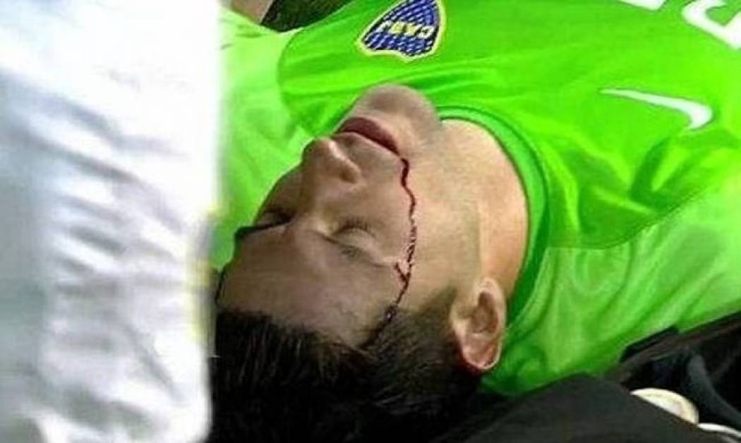 Κτύπησαν στο κεφάλι τον γκολκίπερ της Μπόκα (videos+ photos)