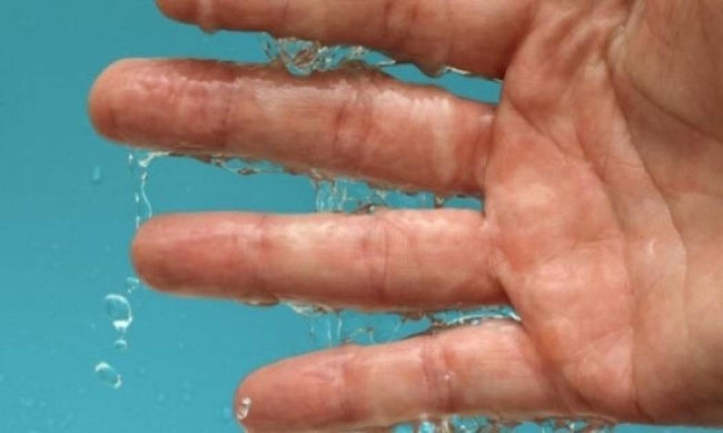 Παλάμες που ιδρώνουν: Πώς θα απαλλαγείτε με φυσικό τρόπο