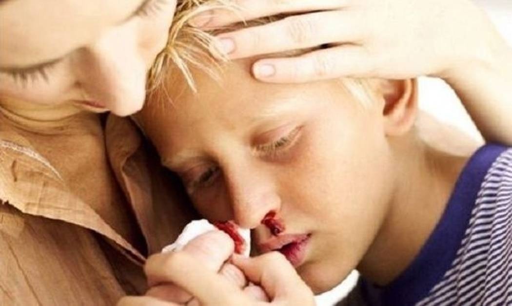 «Σπάει δόντι, χτυπάει το κεφάλι, τρέχει αίμα η μύτη»! Τι πρέπει να κάνετε σε περίπτωση που το παιδί σας τραυματιστεί