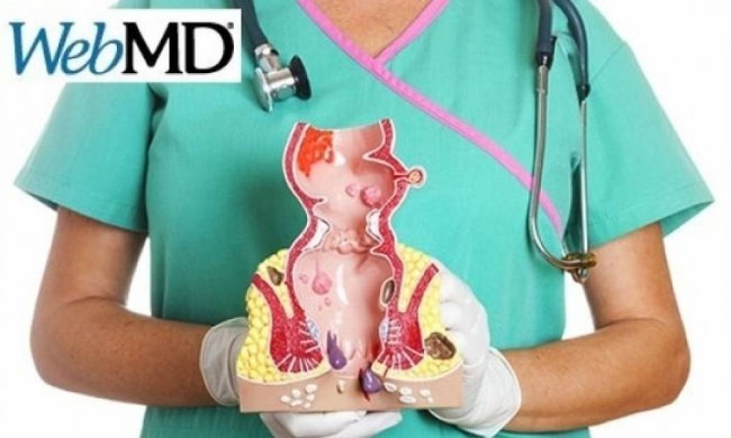 Μάθετε τι είναι οι αιμορροΐδες μέσα από εικόνες