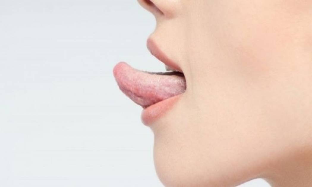 Γλωσσίτιδα: Αίτια κι αντιμετώπιση