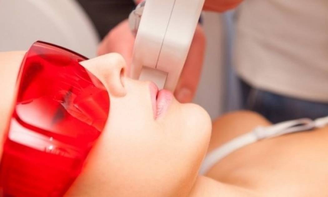 Αποτρίχωση laser: Πόσο αποτελεσματική είναι;