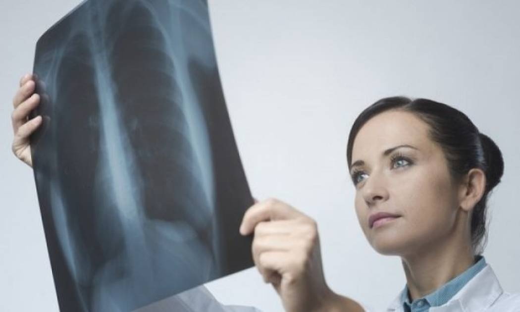 Πλευροχονδρίτιδα: Ποια πάθηση είναι και πώς αντιμετωπίζεται