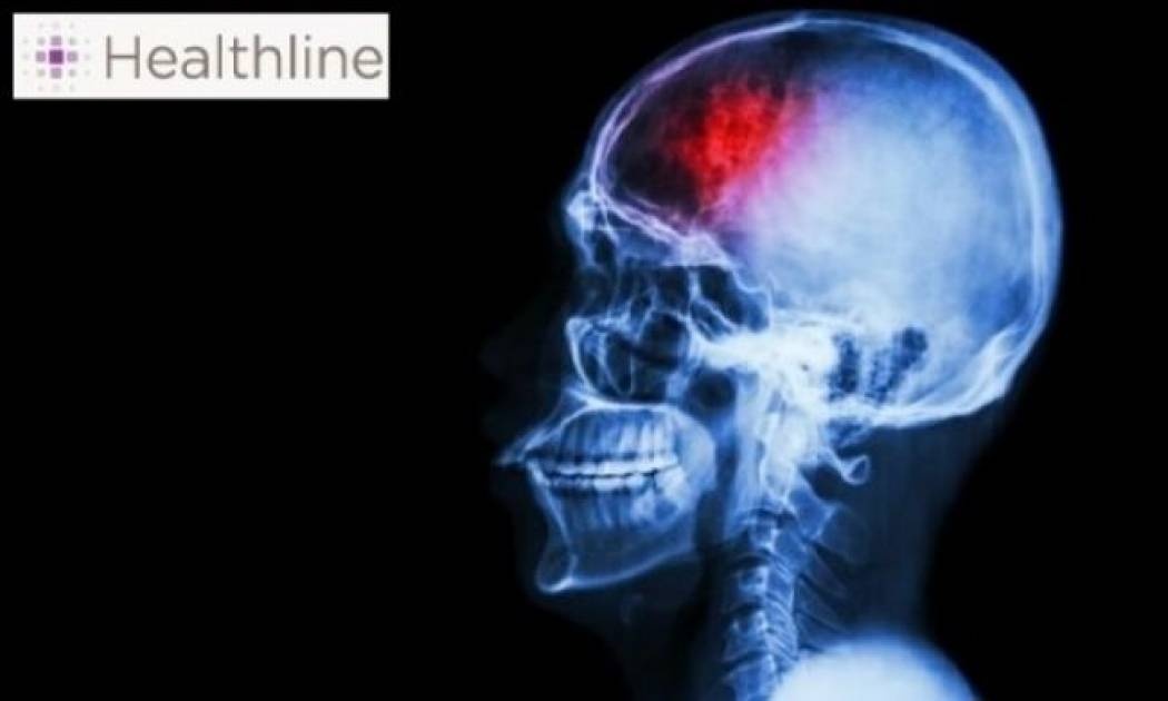 «Μίνι» εγκεφαλικό: Μάθετε τα συμπτώματα!