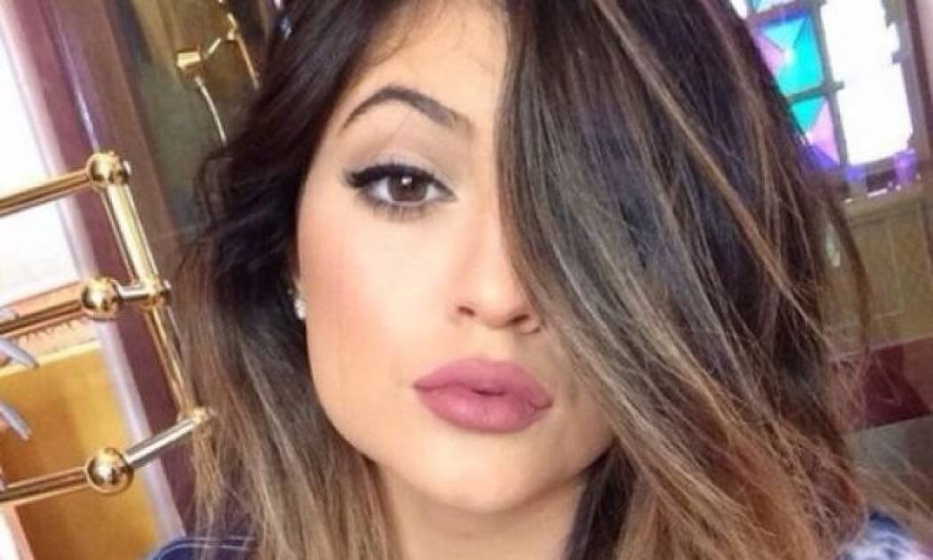 Συναγερμός! Η Kylie Jenner δεν έχει πια χείλη και σας έχουμε τα ντοκουμέντα