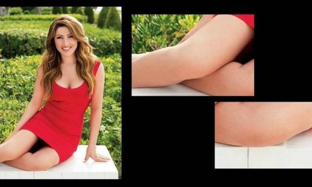 Η Μεγάλη Παρασκευή της Παπαρίζου. Το πλακάκι και η κάκωση στο γόνατο (Nassos blog)