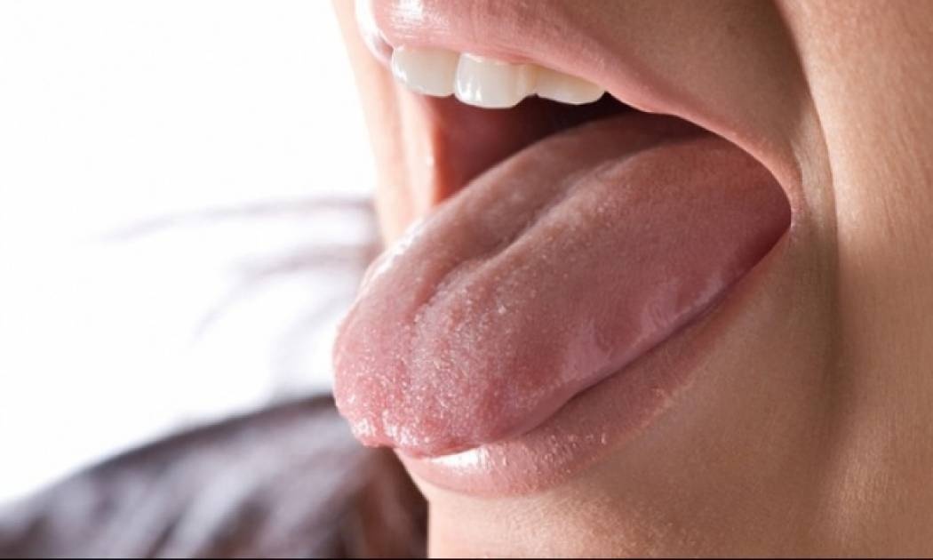 Λευκό χνούδι στη γλώσσα: Τι μπορεί να σημαίνει