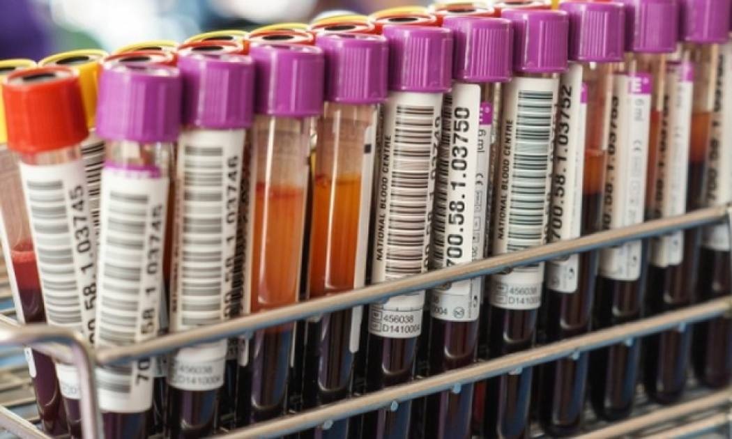 Αυξημένες τρανσαμινάσες: Ποια προβλήματα υγείας δείχνουν