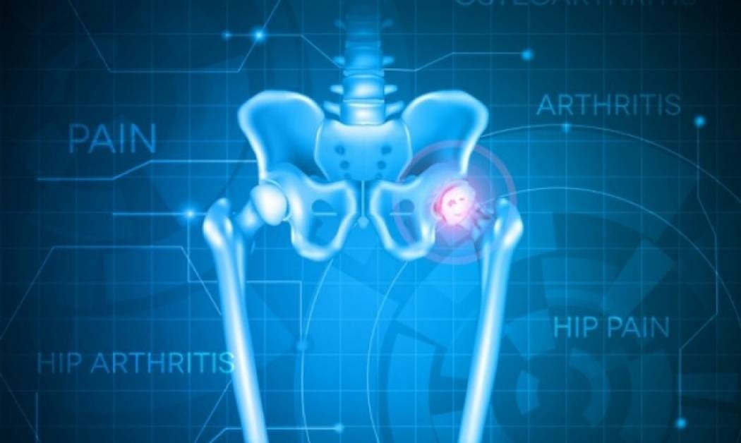 Τροφές και ποτά που καταστρέφουν τις αρθρώσεις σου