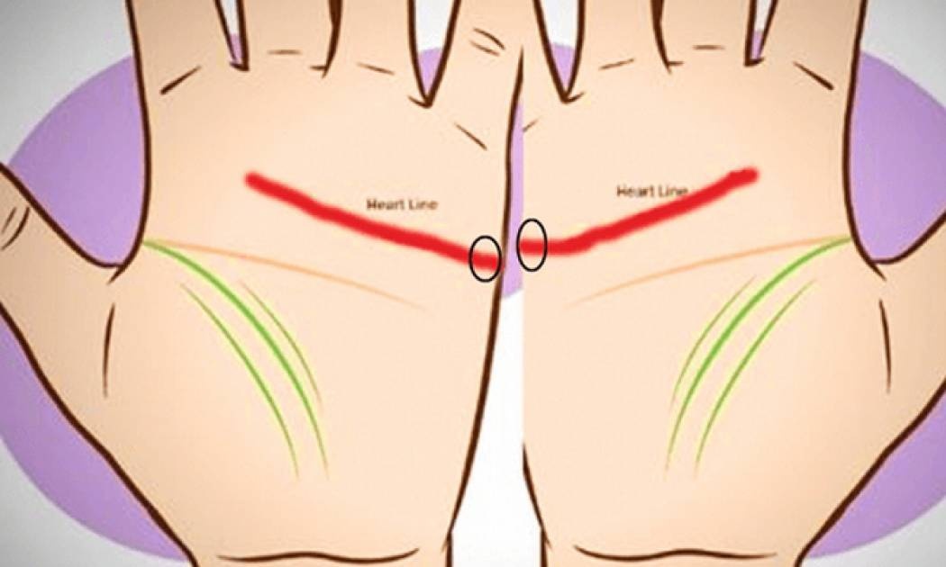 Αν τοποθετήσετε τις παλάμες σας έτσι, έχετε αυτές τις 2 γραμμές; Δείτε τι σημαίνει! (video)