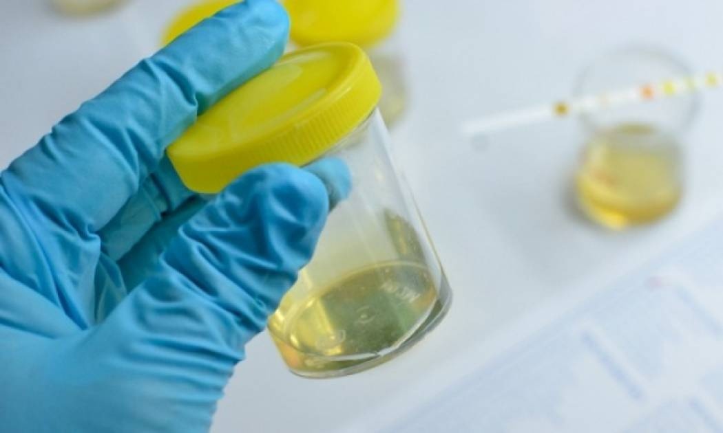 Ποια σοβαρή ασθένεια «προδίδει» η μυρωδιά των ούρων