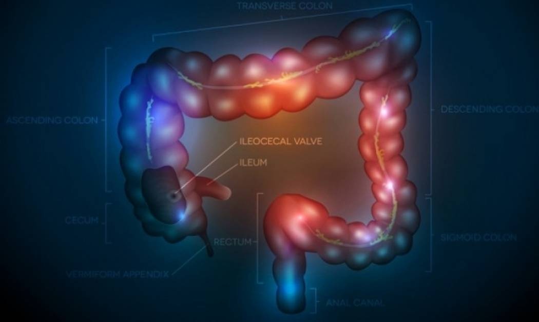 Καρκίνος εντέρου: Ποια είναι τα ανησυχητικά σημάδια, πότε είναι καλύτερη η πρόγνωση