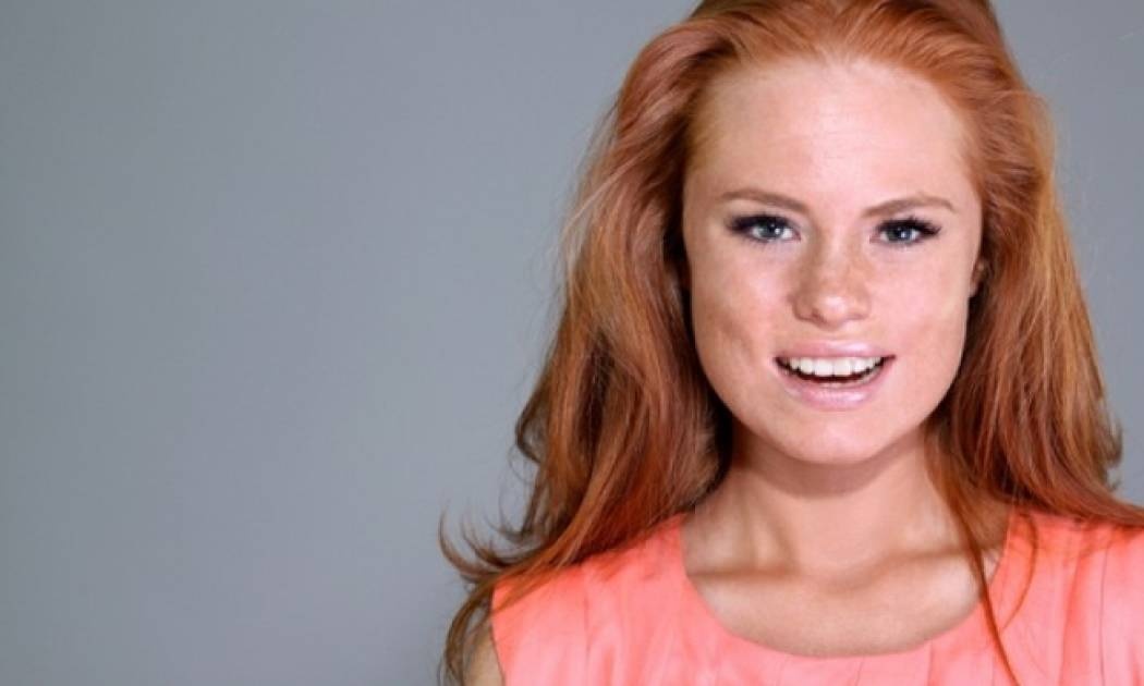 Γιατί οι κοκκινομάλληδες είναι πιο ευαίσθητοι στον πόνο