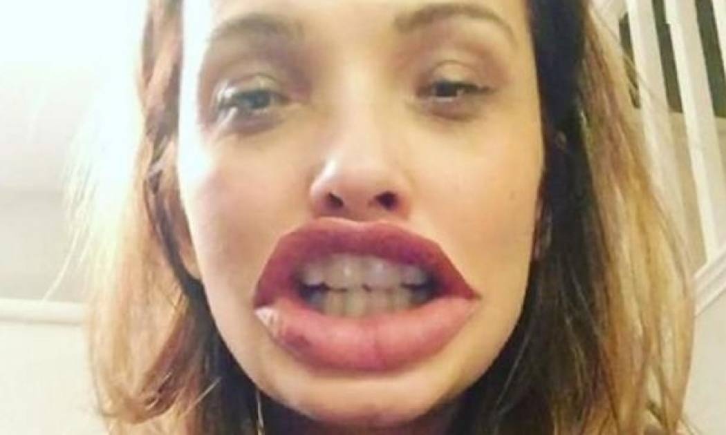 Παναγία μου! Τι έπαθε η Αλέκα Καμηλά;