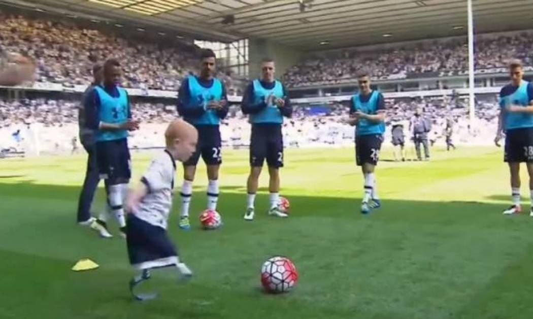 Συγκινητικό! Παιδί με πρόσθετα μέλη έπαιξε ποδόσφαιρο! (videο)