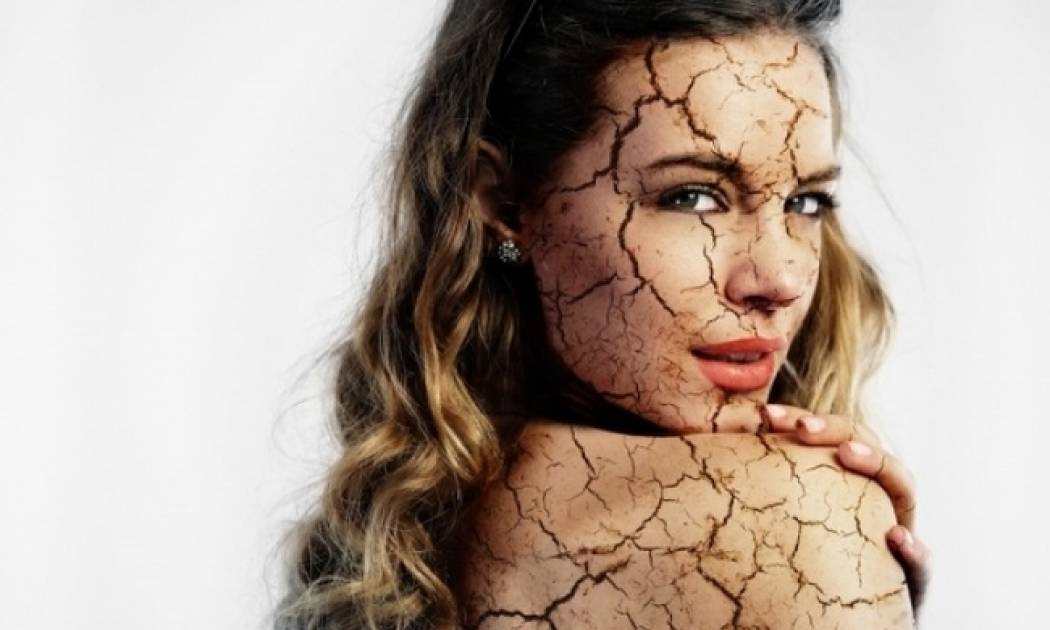 Τέσσερα σημάδια ότι το σώμα σου είναι επικίνδυνα αφυδατωμένο