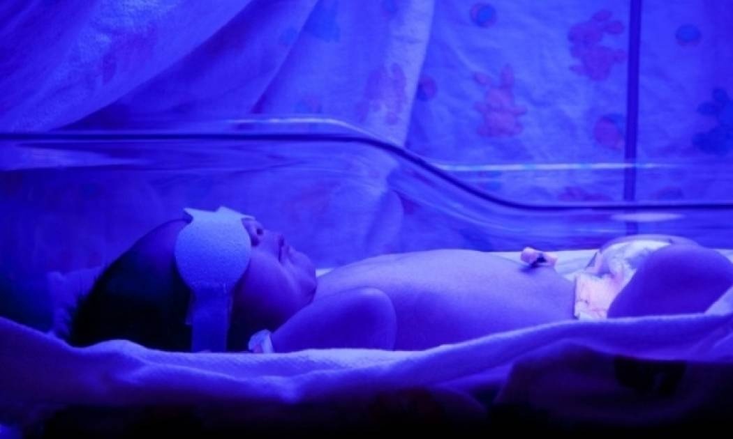 Μωρά με ίκτερο: Ποιο θανάσιμο κίνδυνο κρύβει η φωτοθεραπεία