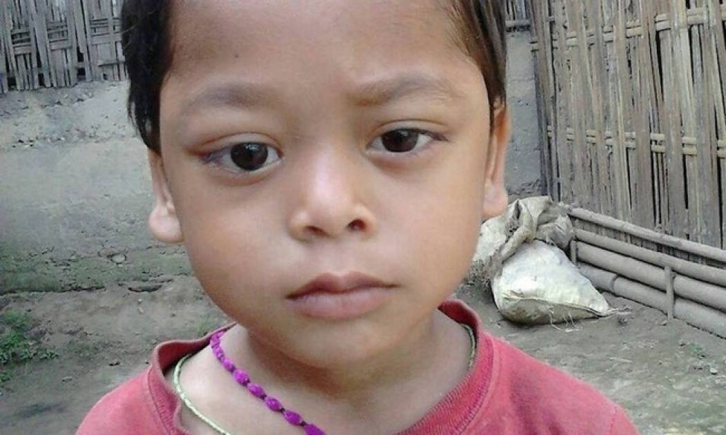 Ινδία: Το αγόρι με τα μάτια που αιμορραγούν – Σοκαριστικές εικόνες