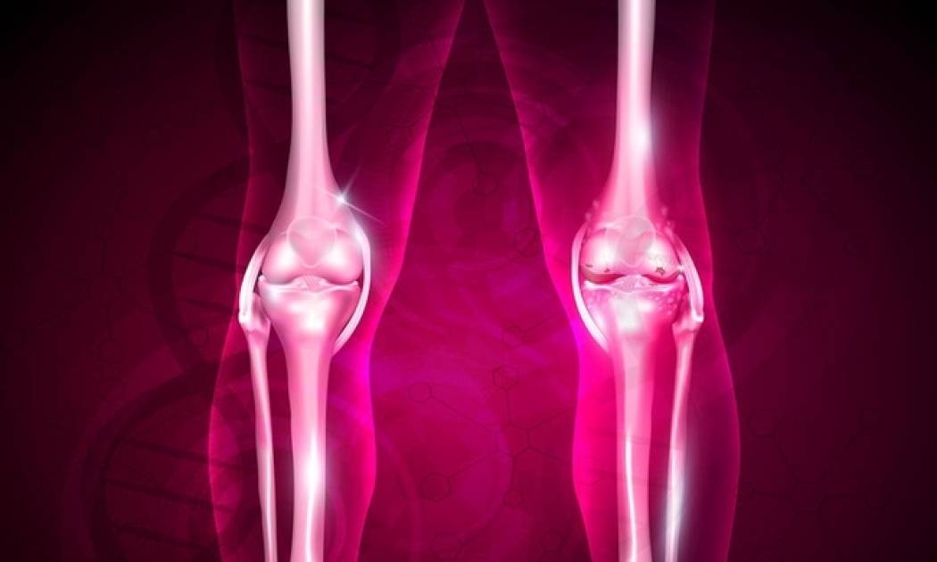 Δυνατά οστά & γυναίκες: Δείτε τι πρέπει να τρώτε