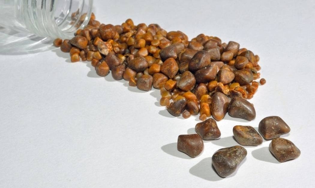 Πέτρες στη χολή: Το συστατικό στη διατροφή που τις προλαμβάνει