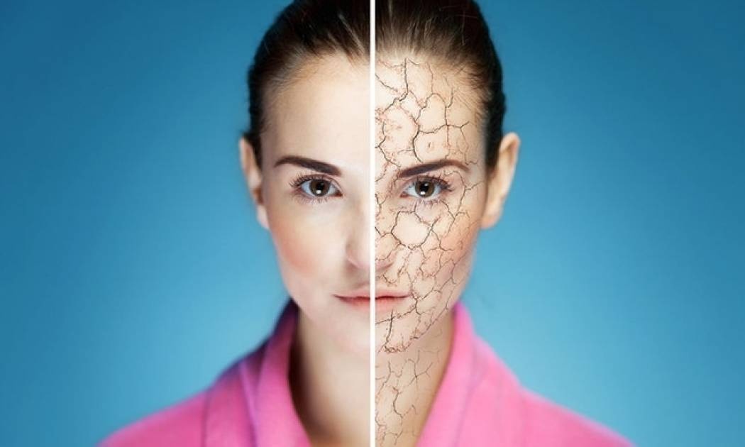 Ξηρό & ερεθισμένο δέρμα: Αντιμετώπιση με αυτές τις 5 τροφές