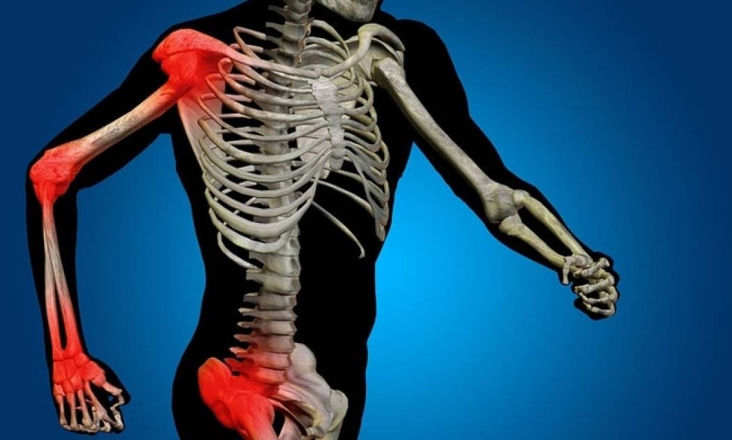 Υγεία οστών: 4 σημάδια που δείχνουν ότι κινδυνεύετε