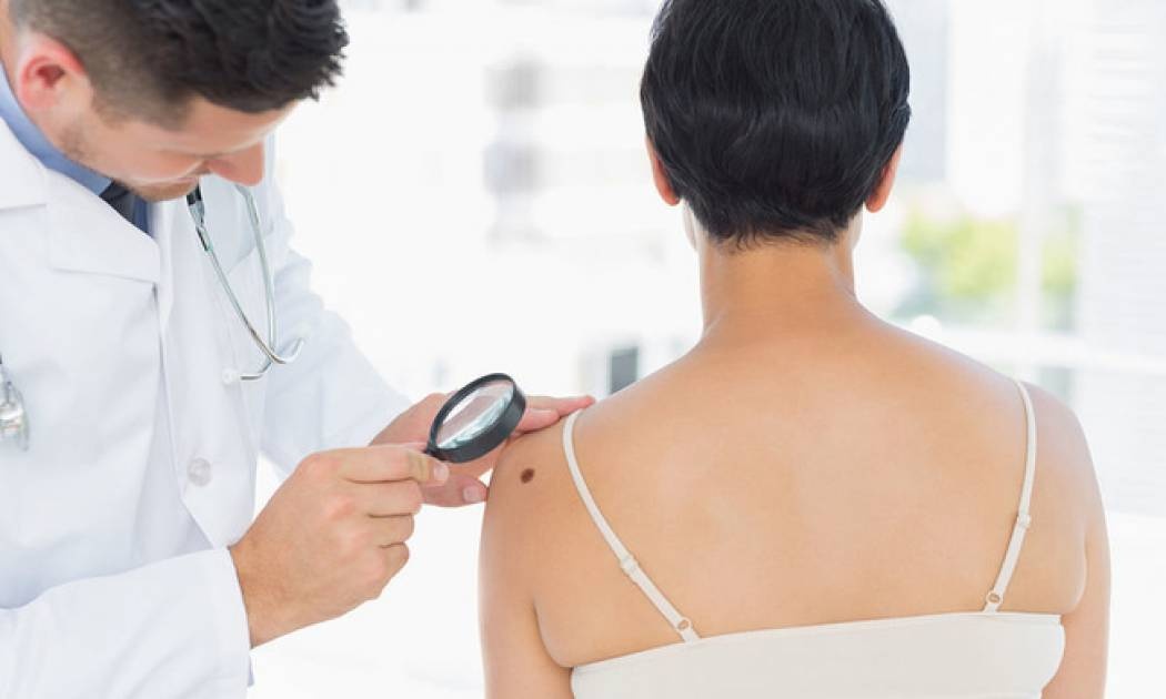 Δυσπλαστικοί σπίλοι & μελάνωμα: Παράγοντες κινδύνου & αντιμετώπιση