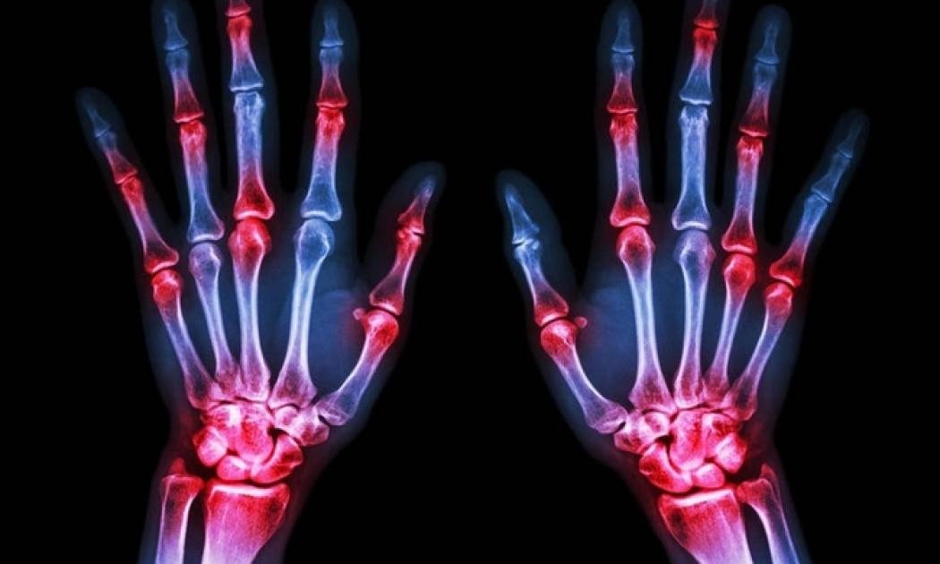 Πόνοι στις αρθρώσεις: 6 ανησυχητικές αιτίες