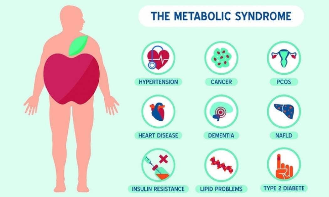 Μεταβολικό σύνδρομο: Τι είναι και ποιοι κινδυνεύουν λιγότερο