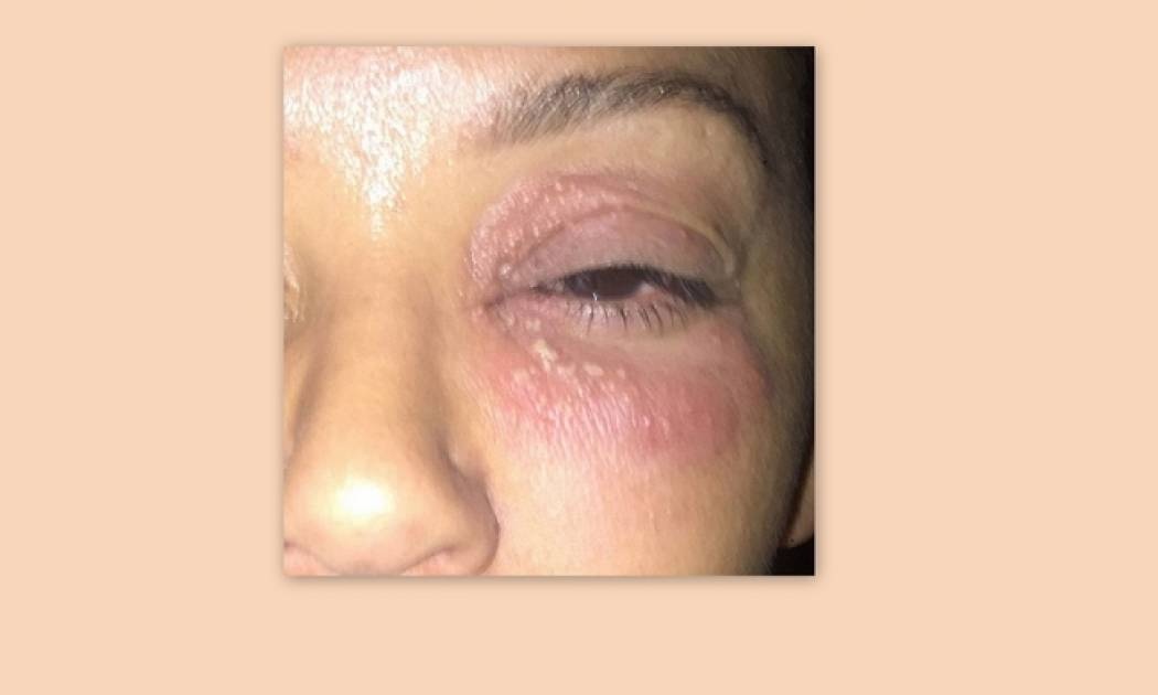 Σοκάρει η πασίγνωστη τραγουδίστρια! Ο ξυλοδαρμός από τον άντρα της – Είχε αφήσει έγκυο τη νταντά