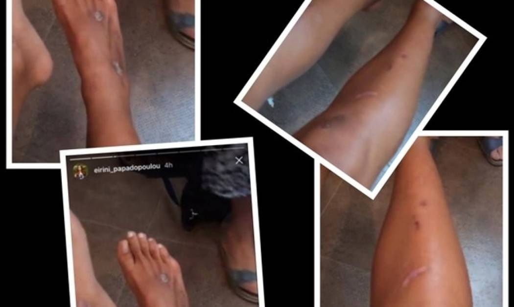 Έτσι είναι το κορμί της Παπαδοπούλου μετά το Survivor. Όσα δεν δείχνουν οι κάμερες (Nassos blog)