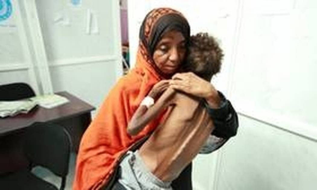 Τα παιδιά στην Υεμένη πεθαίνουν από πείνα