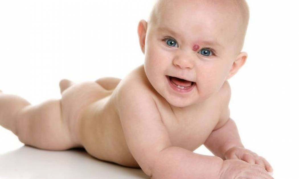 Αιμαγγειώματα στα βρέφη: Που οφείλονται και πώς αντιμετωπίζονται;