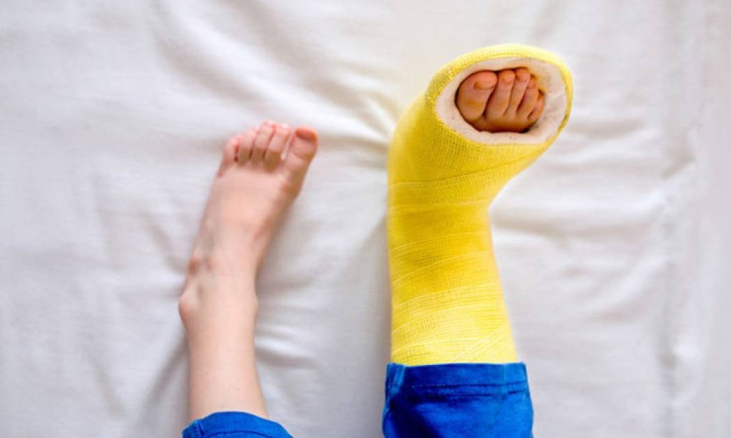 Σημάδια ότι η υγεία των οστών σας κινδυνεύει (εικόνες)