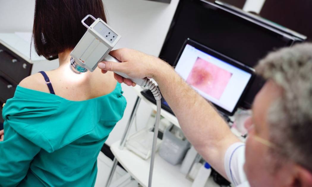 Βασικοκυτταρικό καρκίνωμα: Για ποιους άλλους καρκίνους αυξάνει τον κίνδυνο