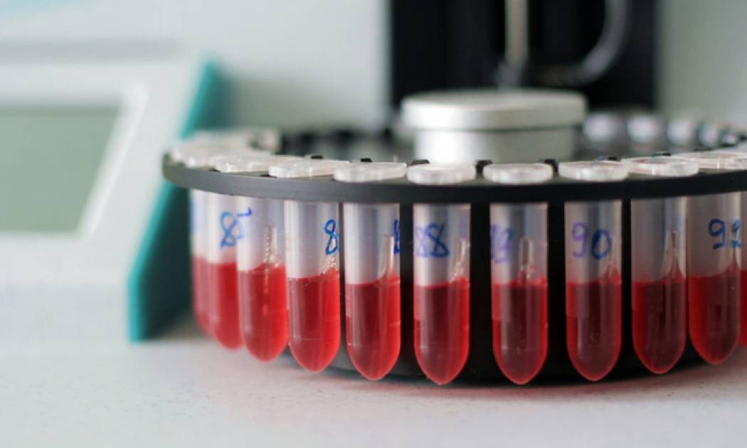 Αυξημένα λευκά αιμοσφαίρια: Δείτε τι σημαίνει ο δείκτης