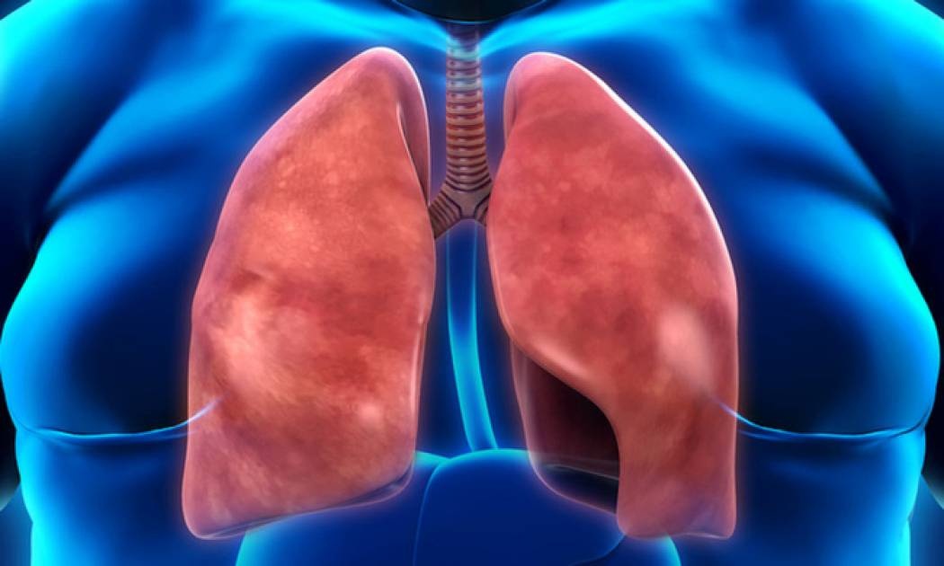 Η αμφίδρομη σχέση παχυσαρκίας και άσθματος