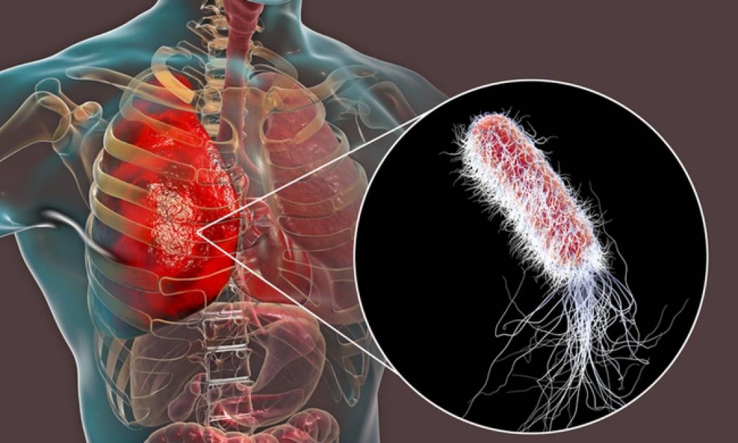 Κυστική ίνωση: Πώς να προστατεύσετε τους ασθενείς από τη γρίπη