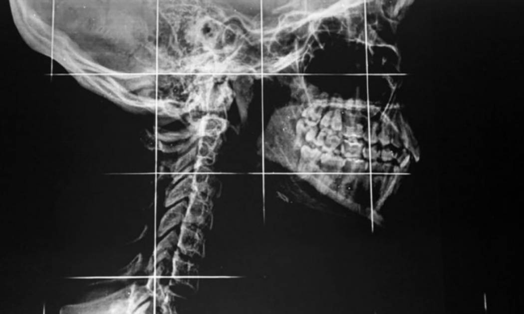 Πόνος στη γνάθο: 6 απίθανες αιτίες που πρέπει να γνωρίζετε (pics)