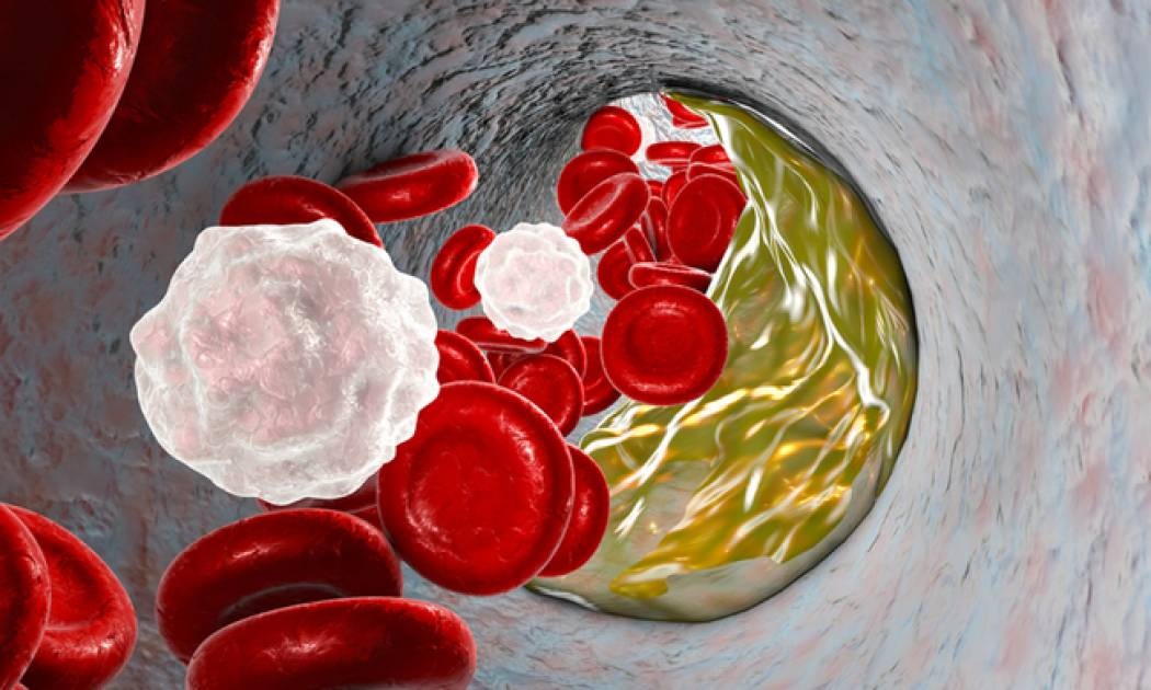 Καρδιαγγειακά: Η διατροφή που μειώνει τον κίνδυνο κατά 25%