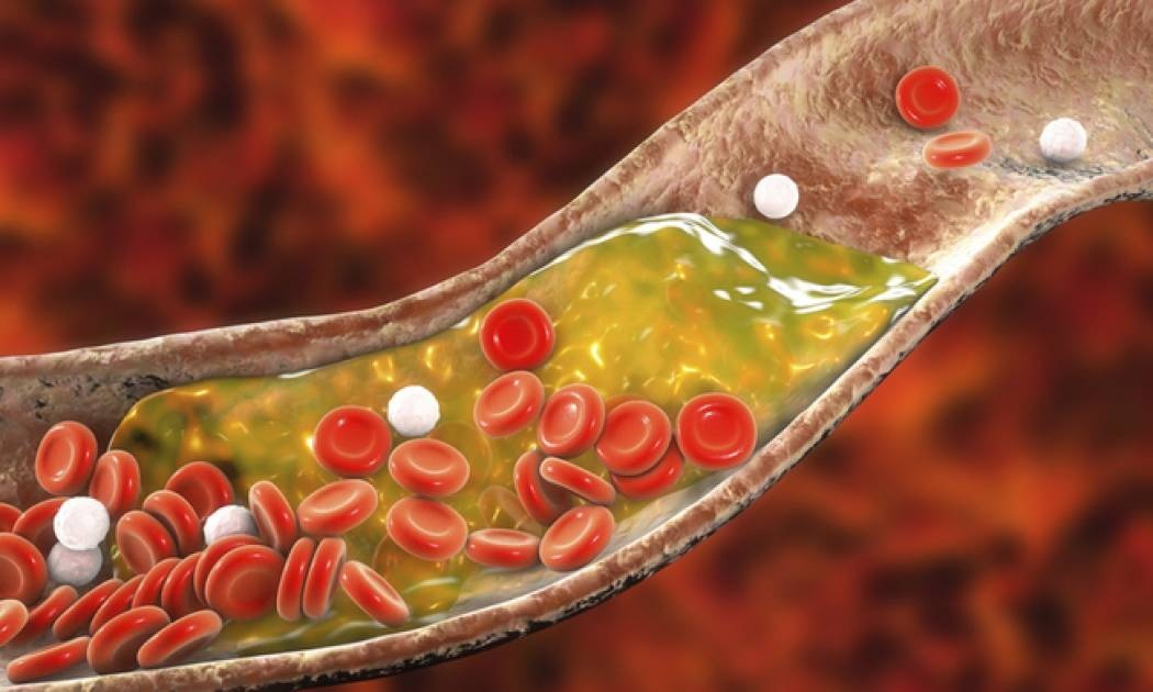 Στεφαναία νόσος: Η απλή άσκηση που θωρακίζει την καρδιά