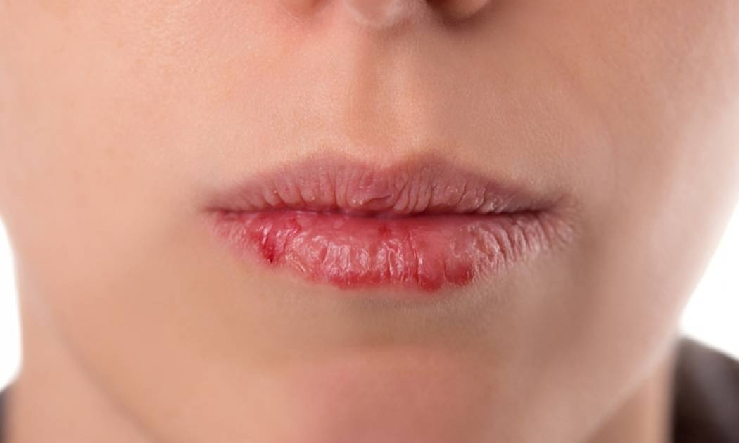 Tips περιποίησης των ξηρών και σκασμένων χειλιών (video)